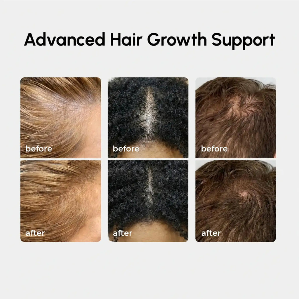 4-in-1 Haarwachstumsspray