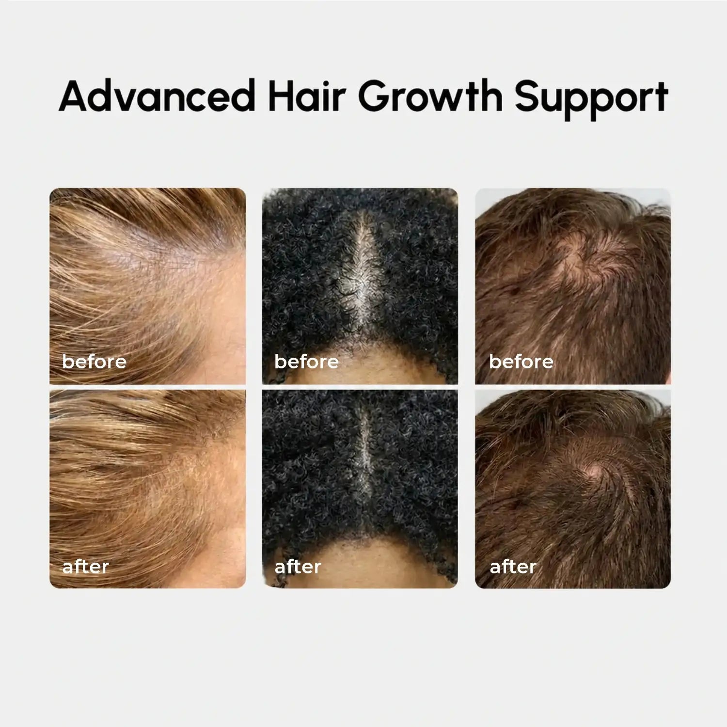 4-in-1 Haarwachstumsspray