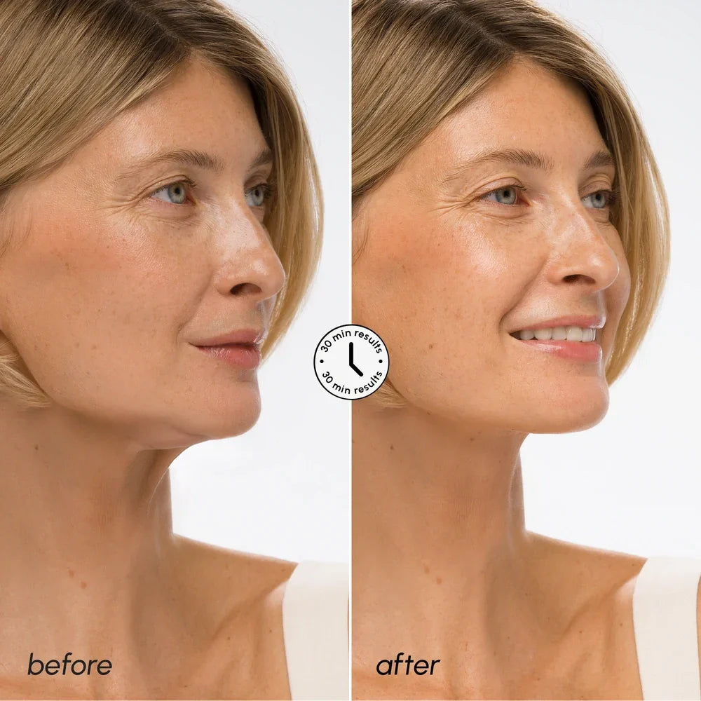Hyaluronsäure V-Linien-Lifting-Maske
