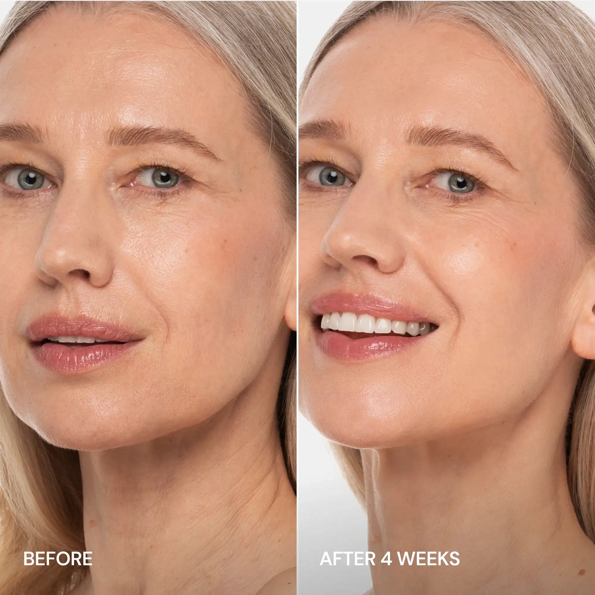 Pro-Retinol Halsstraffungscreme mit Massageapplikator