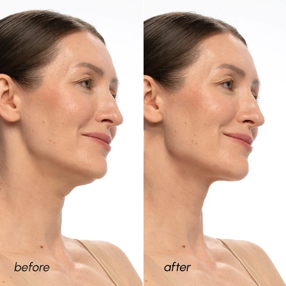 PDRN V-Line Lifting-Maske