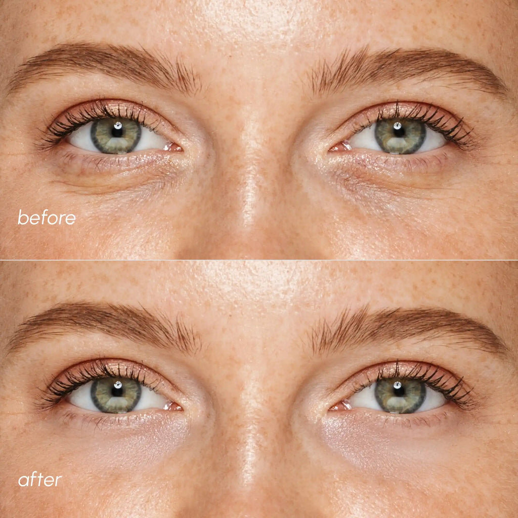 Pinke Augenpads für geschwollene Augen