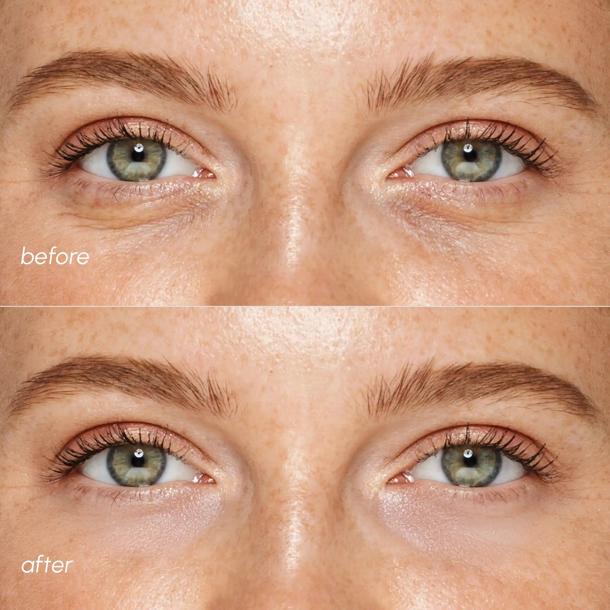 Pinke Augenpads für geschwollene Augen