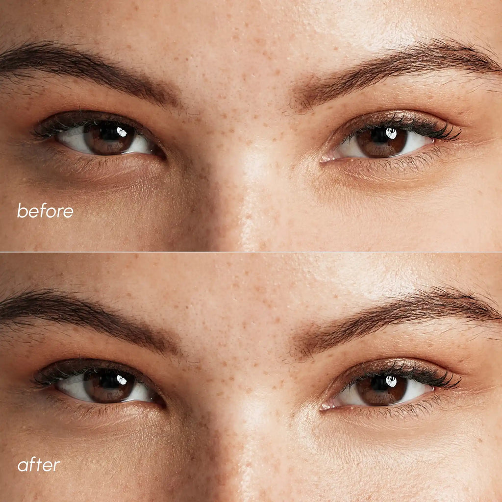 Pinke Augenpads für geschwollene Augen